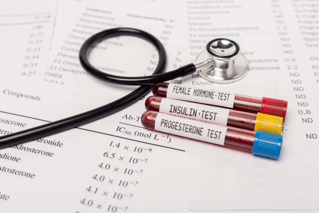 Three blood tests on a paper next to a stethoscope.